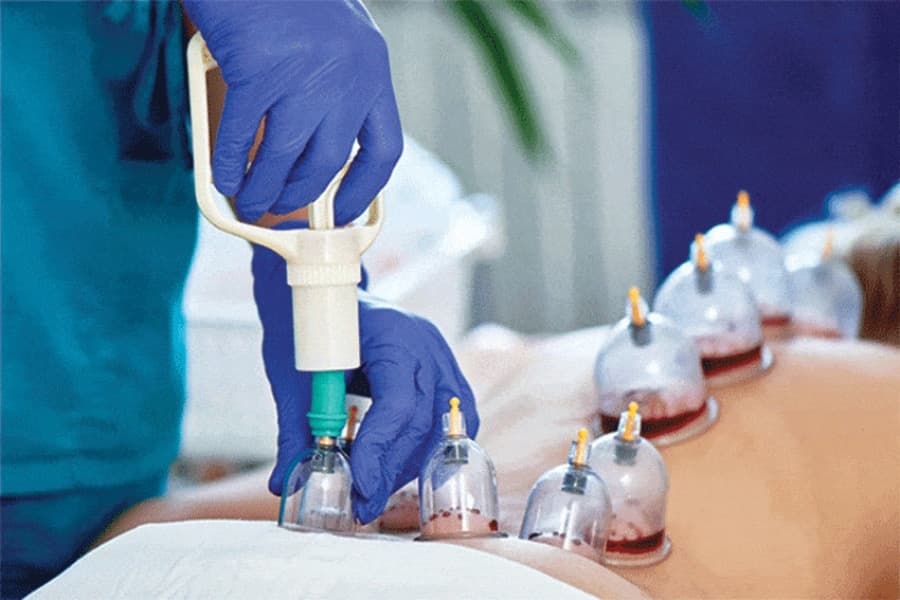 Thoughtful Hijama therapy and personal attention